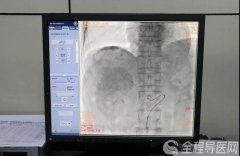 徐州介入科专家袁磊：错过外科手术时机，也要创造肿瘤治疗机会！