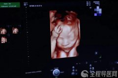 徐州妇幼保健院助产士提醒：孕妈们的这些坏习惯，会让羊水质量变差
